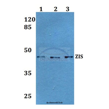 Anti-ZIS (I144) Antibody from Bioworld Technology (BS1900) - Antibodies.com