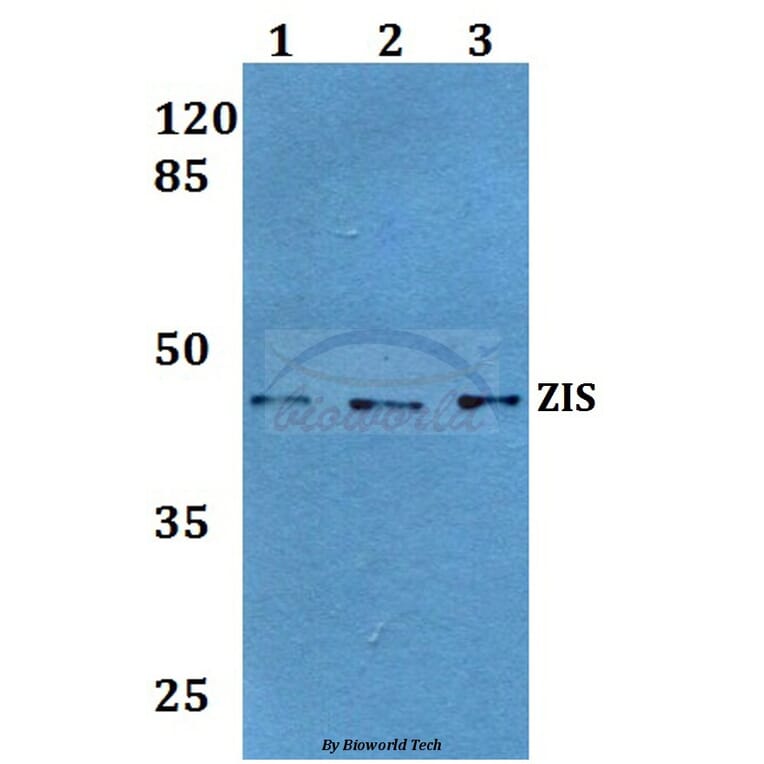 Anti-ZIS (I144) Antibody from Bioworld Technology (BS1900) - Antibodies.com