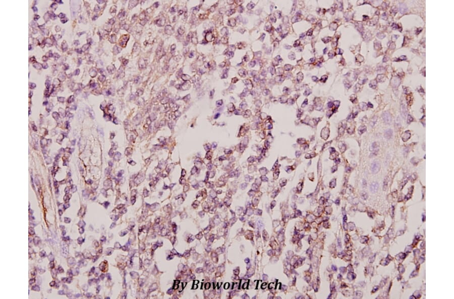 Anti-ZIS (I144) Antibody from Bioworld Technology (BS1900) - Antibodies.com