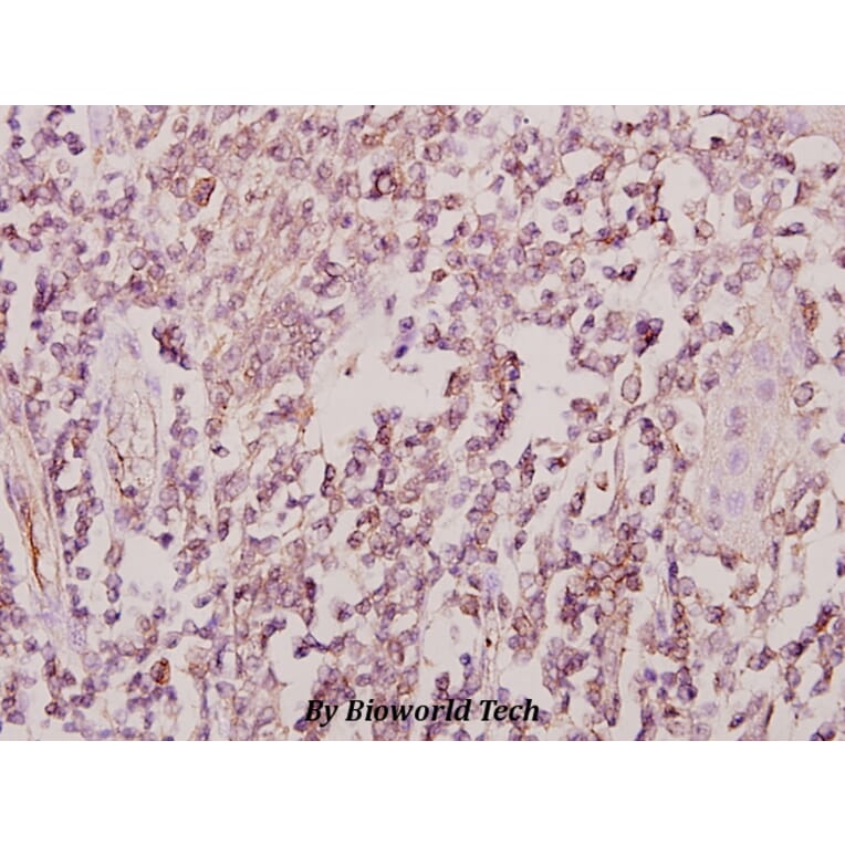 Anti-ZIS (I144) Antibody from Bioworld Technology (BS1900) - Antibodies.com