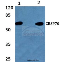 Anti-CRSP70 (S7) Antibody from Bioworld Technology (BS1902) - Antibodies.com