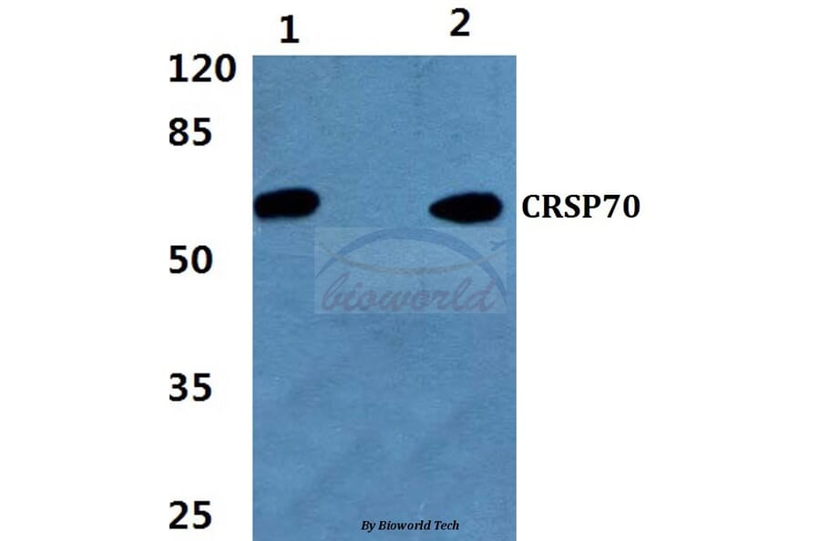 Anti-CRSP70 (S7) Antibody from Bioworld Technology (BS1902) - Antibodies.com