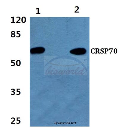 Anti-CRSP70 (S7) Antibody from Bioworld Technology (BS1902) - Antibodies.com