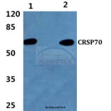 Anti-CRSP70 (S7) Antibody from Bioworld Technology (BS1902) - Antibodies.com