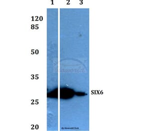 Anti-Six3/6 (D228) Antibody from Bioworld Technology (BS1903) - Antibodies.com