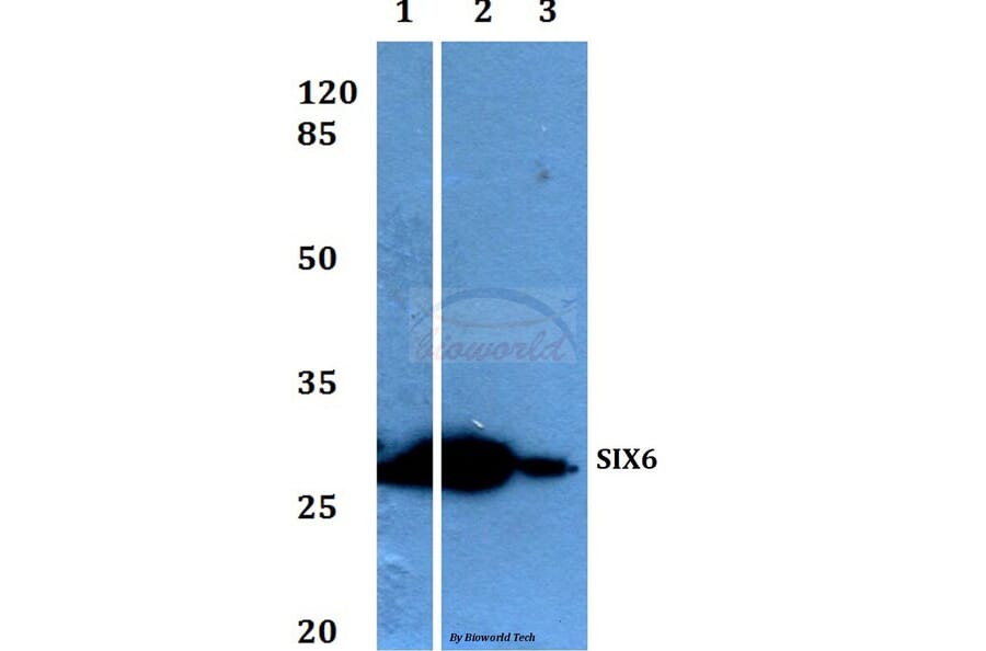 Anti-Six3/6 (D228) Antibody from Bioworld Technology (BS1903) - Antibodies.com