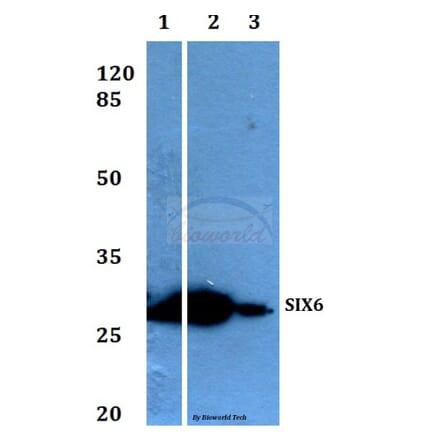 Anti-Six3/6 (D228) Antibody from Bioworld Technology (BS1903) - Antibodies.com