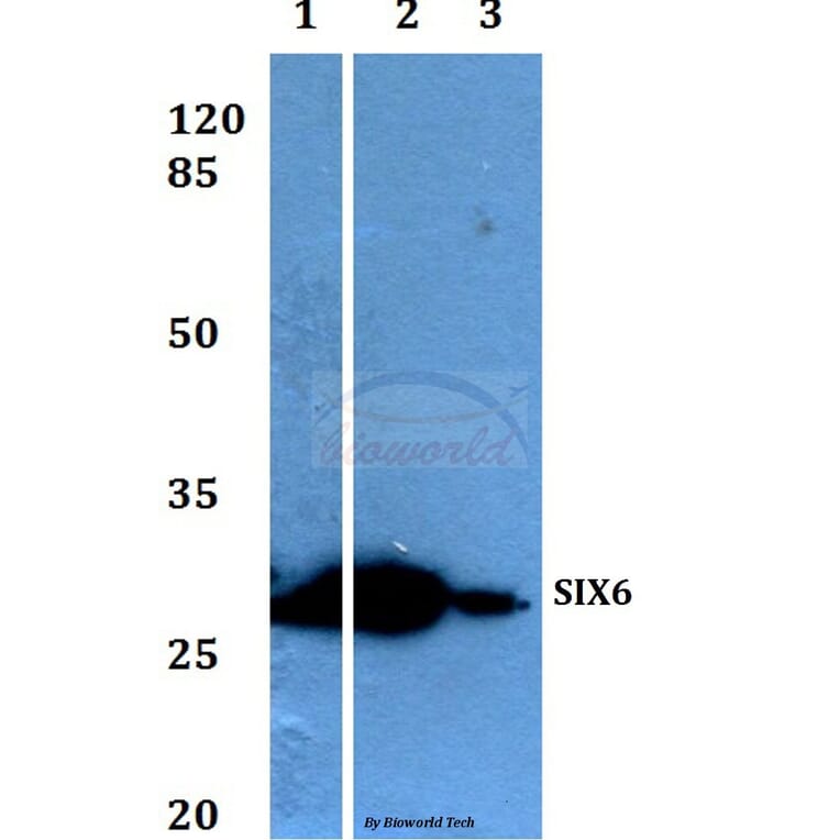Anti-Six3/6 (D228) Antibody from Bioworld Technology (BS1903) - Antibodies.com