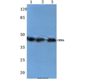 Anti-CBX6 (K18) Antibody from Bioworld Technology (BS1904) - Antibodies.com