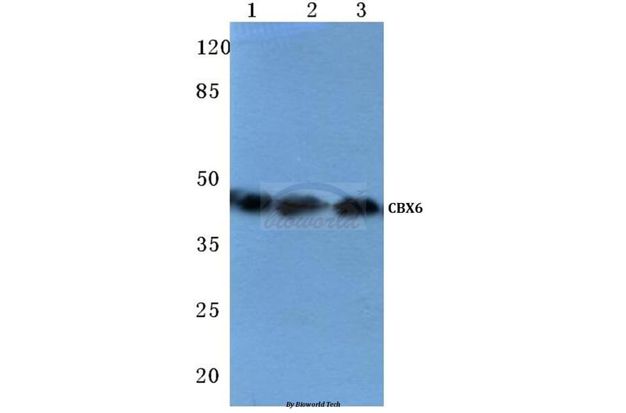 Anti-CBX6 (K18) Antibody from Bioworld Technology (BS1904) - Antibodies.com