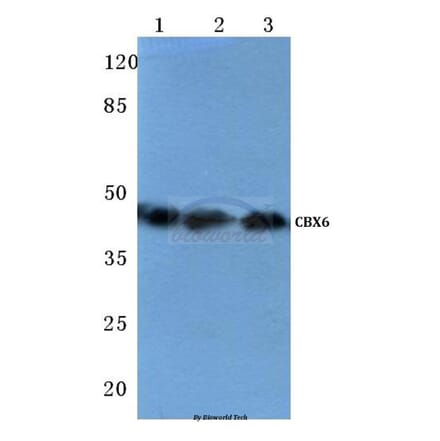 Anti-CBX6 (K18) Antibody from Bioworld Technology (BS1904) - Antibodies.com