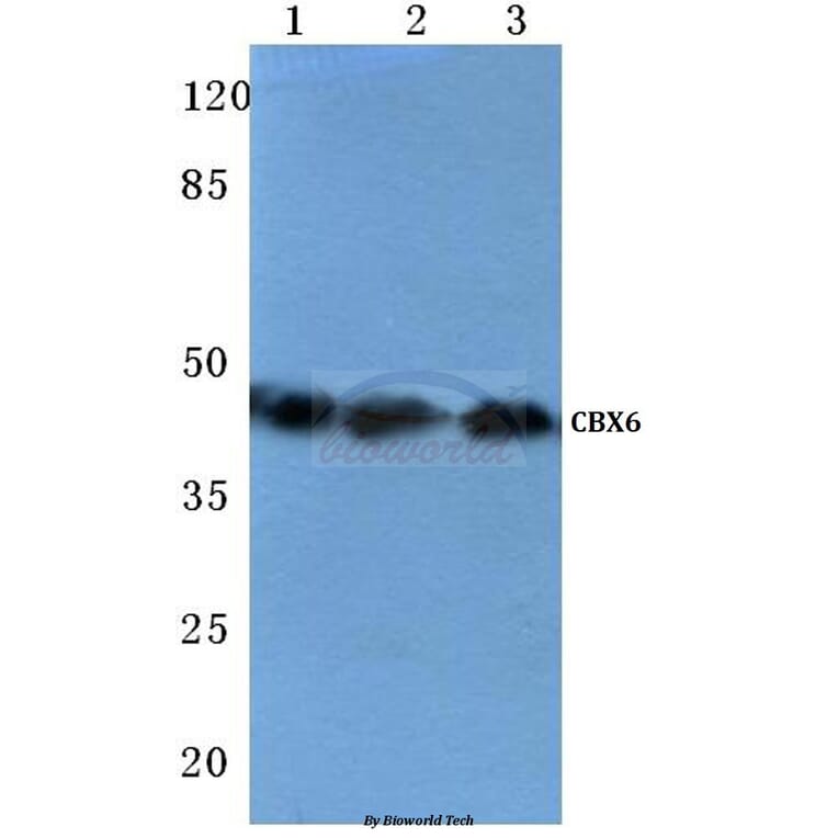 Anti-CBX6 (K18) Antibody from Bioworld Technology (BS1904) - Antibodies.com