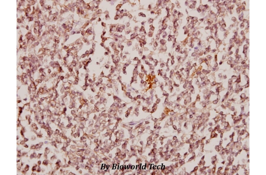 Anti-CBX6 (K18) Antibody from Bioworld Technology (BS1904) - Antibodies.com