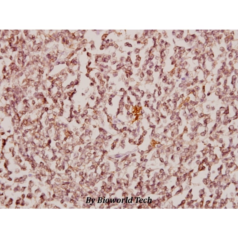 Anti-CBX6 (K18) Antibody from Bioworld Technology (BS1904) - Antibodies.com