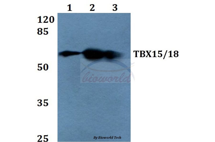 Anti-TBX15/18 (D164) Antibody from Bioworld Technology (BS1907) - Antibodies.com