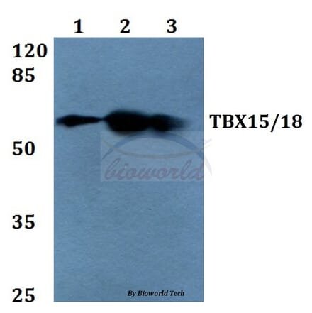 Anti-TBX15/18 (D164) Antibody from Bioworld Technology (BS1907) - Antibodies.com
