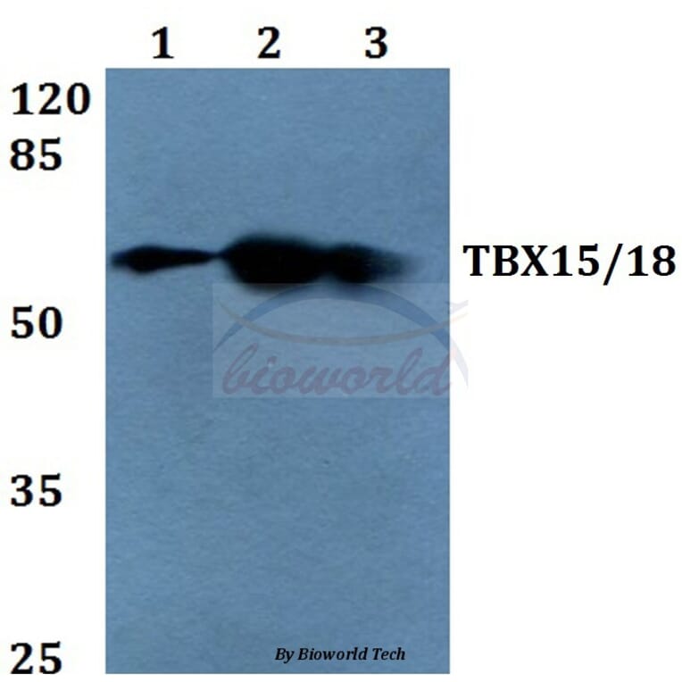Anti-TBX15/18 (D164) Antibody from Bioworld Technology (BS1907) - Antibodies.com