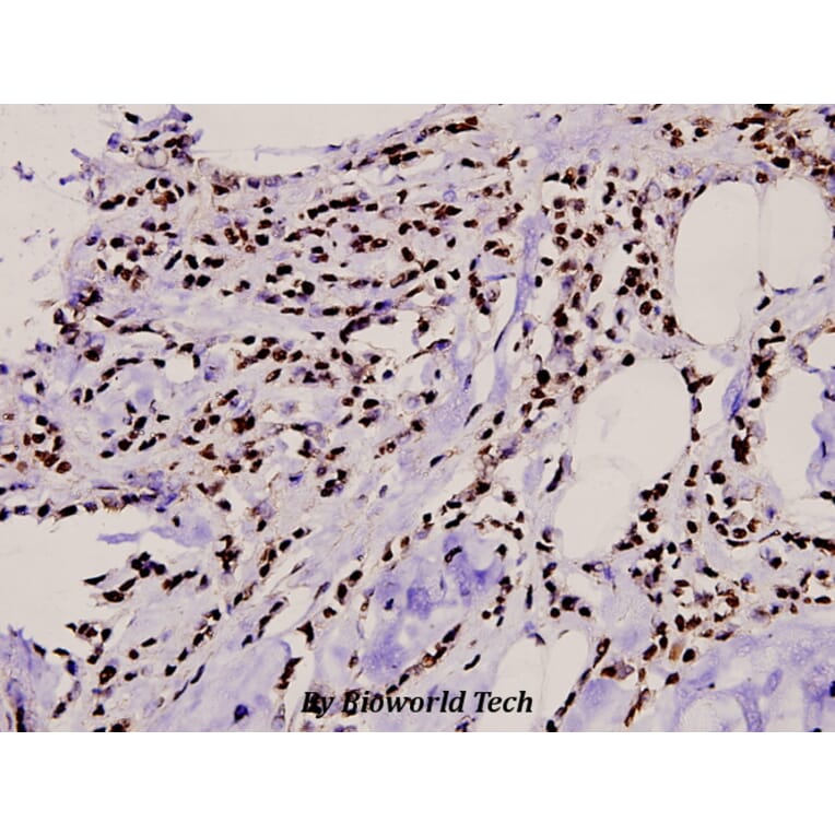 Anti-TBX15/18 (D164) Antibody from Bioworld Technology (BS1907) - Antibodies.com