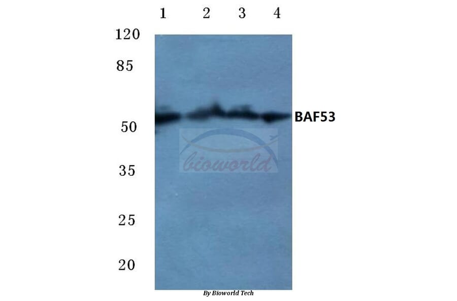 Anti-BAF53 (W237) Antibody from Bioworld Technology (BS1910) - Antibodies.com