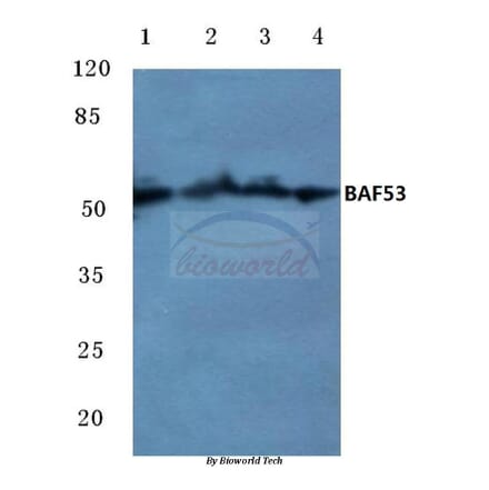 Anti-BAF53 (W237) Antibody from Bioworld Technology (BS1910) - Antibodies.com