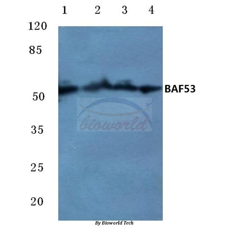 Anti-BAF53 (W237) Antibody from Bioworld Technology (BS1910) - Antibodies.com