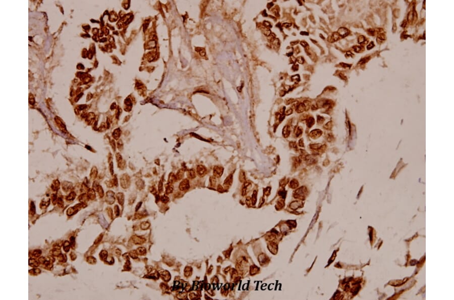 Anti-BAF53 (W237) Antibody from Bioworld Technology (BS1910) - Antibodies.com
