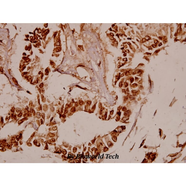 Anti-BAF53 (W237) Antibody from Bioworld Technology (BS1910) - Antibodies.com