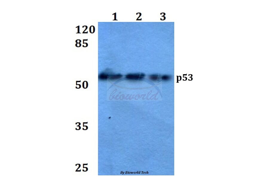 Anti-p53 (L330) Antibody from Bioworld Technology (BS1913) - Antibodies.com