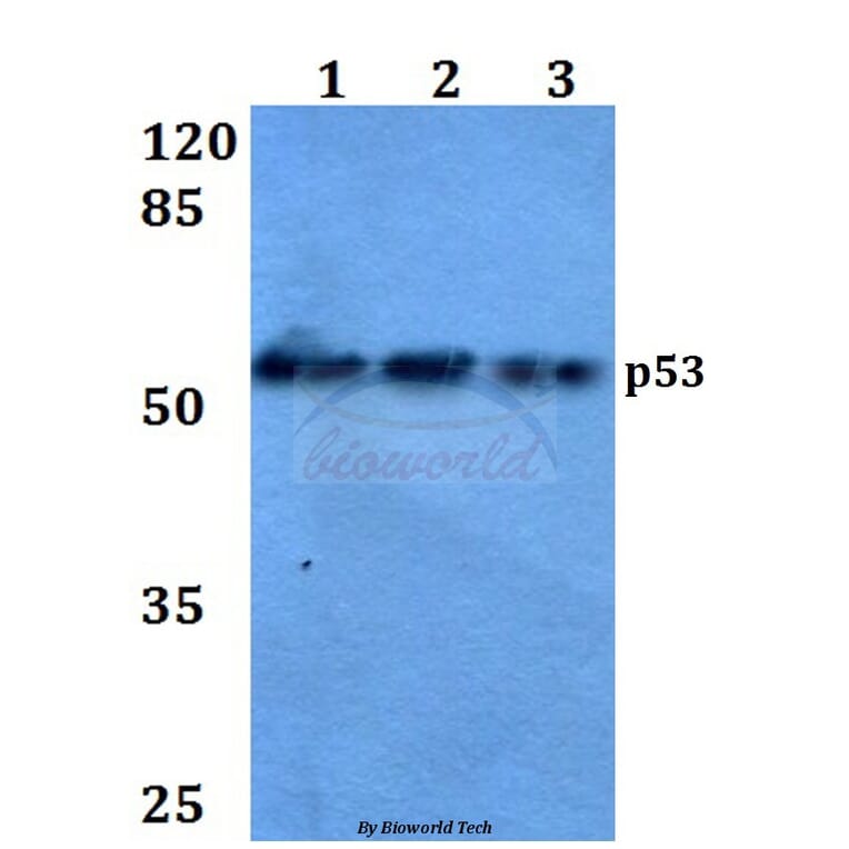 Anti-p53 (L330) Antibody from Bioworld Technology (BS1913) - Antibodies.com