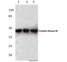 Anti-Creatine Kinase M (Y14) Antibody from Bioworld Technology (BS1915) - Antibodies.com