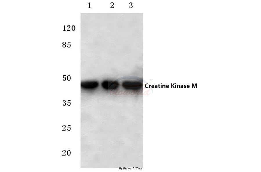 Anti-Creatine Kinase M (Y14) Antibody from Bioworld Technology (BS1915) - Antibodies.com