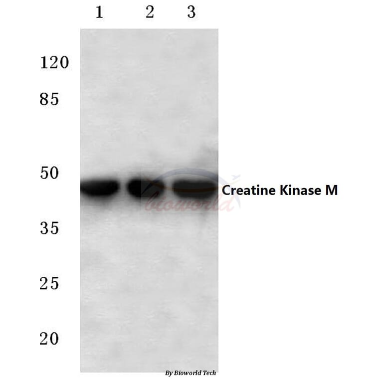 Anti-Creatine Kinase M (Y14) Antibody from Bioworld Technology (BS1915) - Antibodies.com