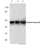 Anti-Creatine Kinase M (Y14) Antibody from Bioworld Technology (BS1915) - Antibodies.com
