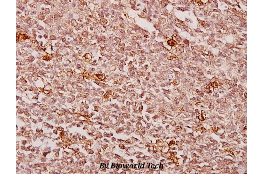 Anti-Creatine Kinase M (Y14) Antibody from Bioworld Technology (BS1915) - Antibodies.com