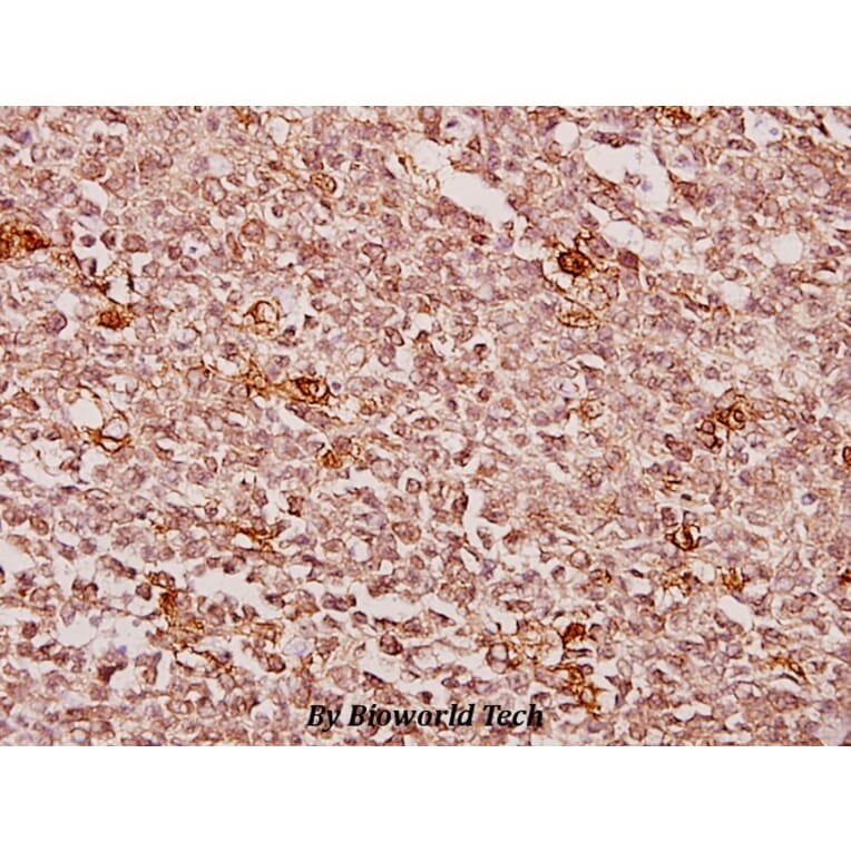 Anti-Creatine Kinase M (Y14) Antibody from Bioworld Technology (BS1915) - Antibodies.com