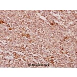 Anti-Creatine Kinase M (Y14) Antibody from Bioworld Technology (BS1915) - Antibodies.com