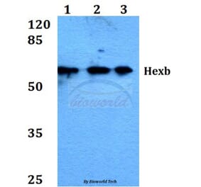 Anti-Hexb (S516) Antibody from Bioworld Technology (BS1917) - Antibodies.com