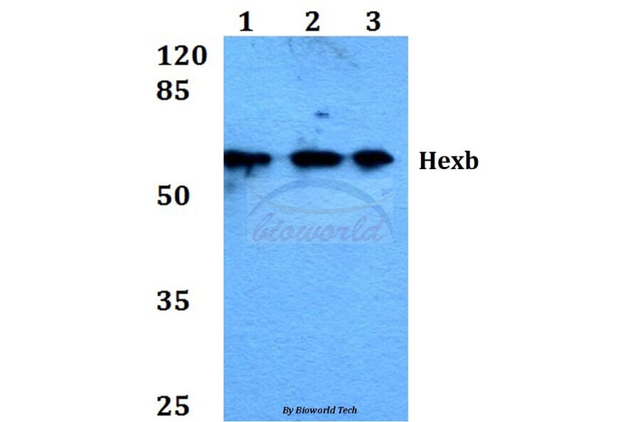 Anti-Hexb (S516) Antibody from Bioworld Technology (BS1917) - Antibodies.com