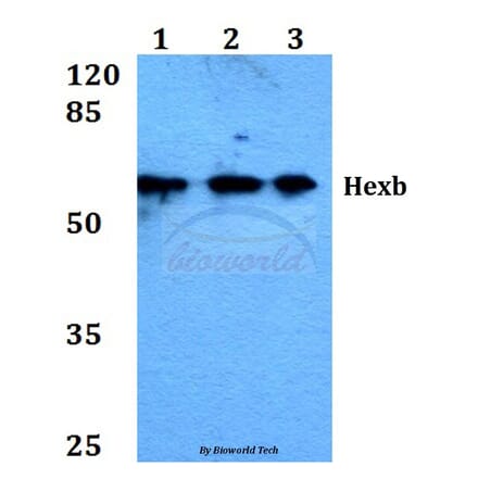 Anti-Hexb (S516) Antibody from Bioworld Technology (BS1917) - Antibodies.com