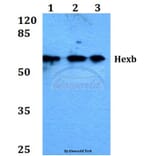 Anti-Hexb (S516) Antibody from Bioworld Technology (BS1917) - Antibodies.com