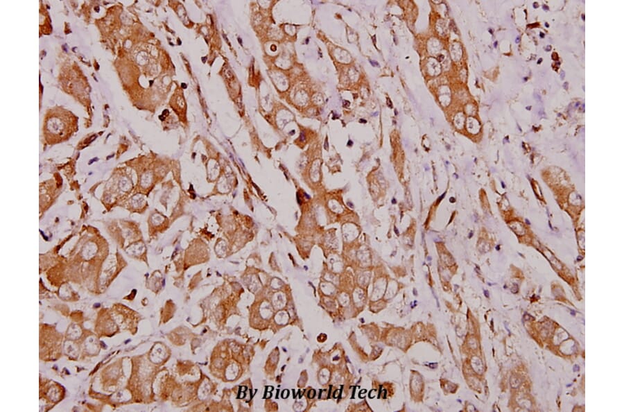 Anti-Hexb (S516) Antibody from Bioworld Technology (BS1917) - Antibodies.com