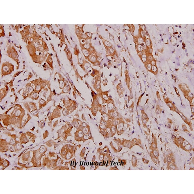 Anti-Hexb (S516) Antibody from Bioworld Technology (BS1917) - Antibodies.com