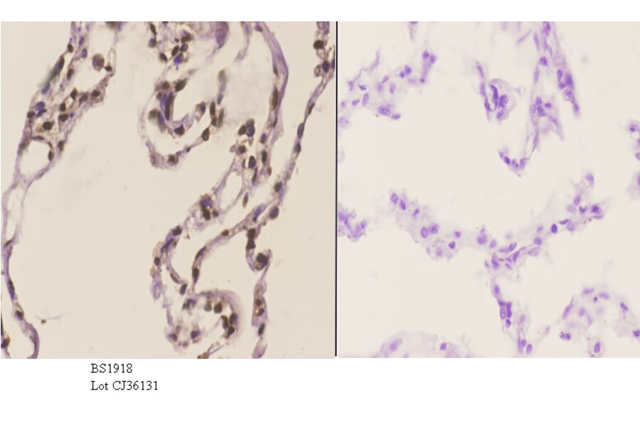 Anti-HMGB1 (A164) Antibody from Bioworld Technology (BS1918) - Antibodies.com