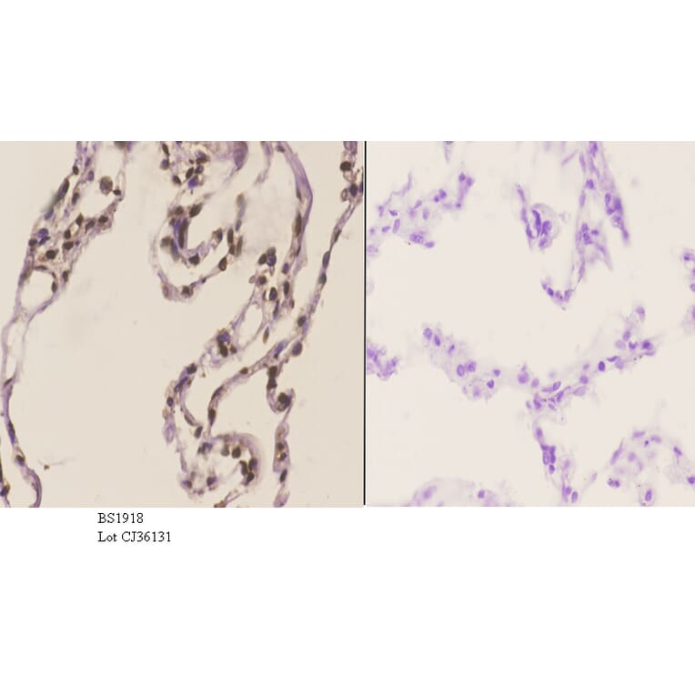 Anti-HMGB1 (A164) Antibody from Bioworld Technology (BS1918) - Antibodies.com