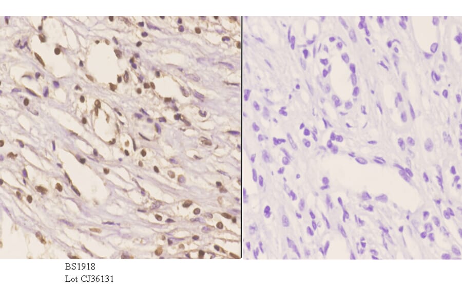 Anti-HMGB1 (A164) Antibody from Bioworld Technology (BS1918) - Antibodies.com