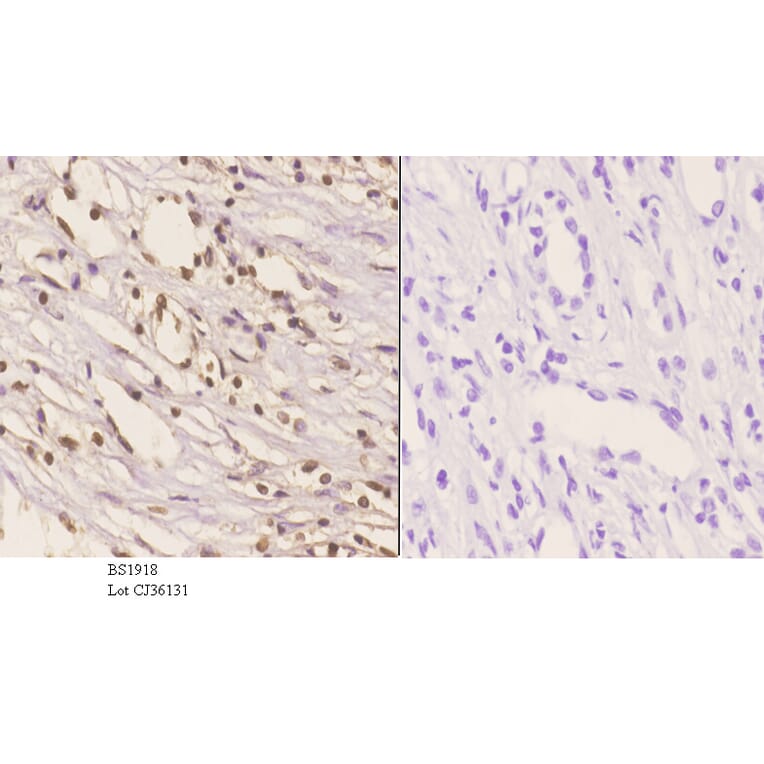 Anti-HMGB1 (A164) Antibody from Bioworld Technology (BS1918) - Antibodies.com