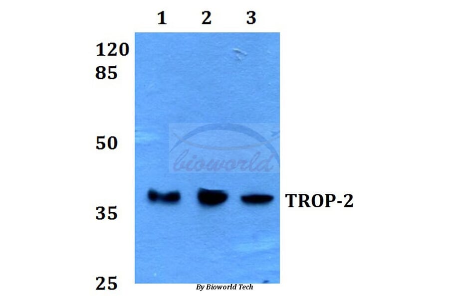 Anti-TROP-2 (F167) Antibody from Bioworld Technology (BS1920) - Antibodies.com