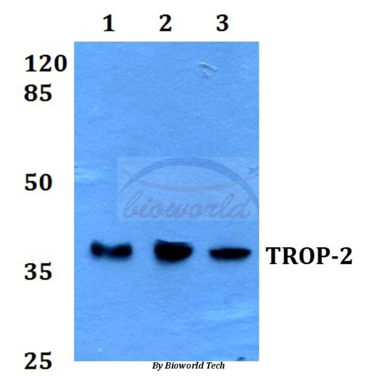 Anti-TROP-2 (F167) Antibody from Bioworld Technology (BS1920) - Antibodies.com
