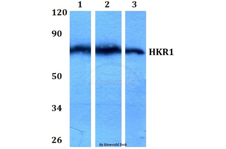 Anti-HKR1 (W154) Antibody from Bioworld Technology (BS1923) - Antibodies.com