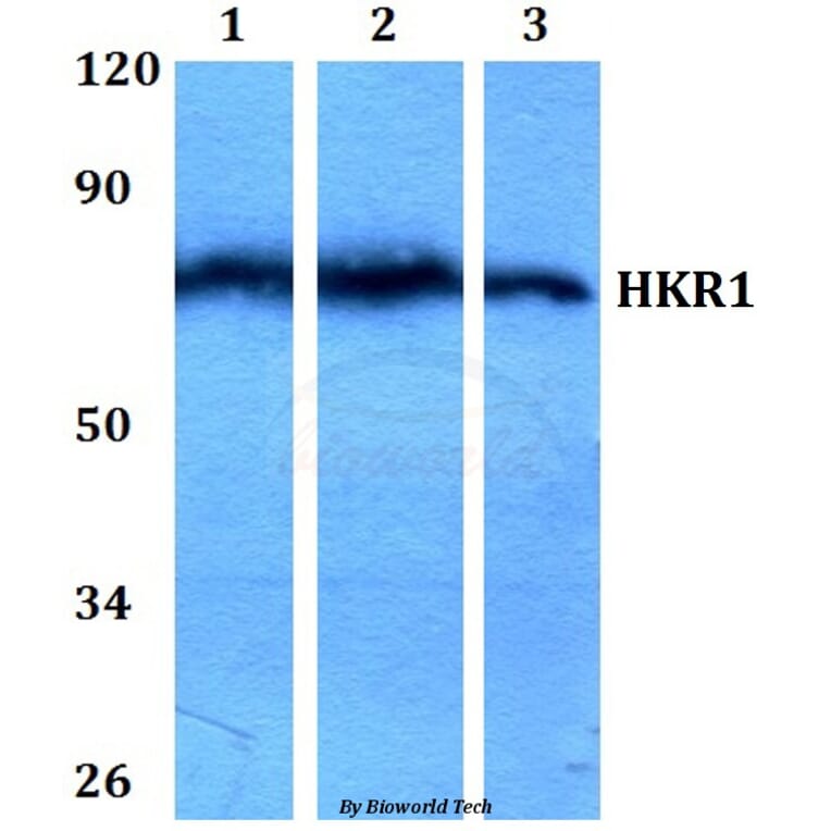 Anti-HKR1 (W154) Antibody from Bioworld Technology (BS1923) - Antibodies.com